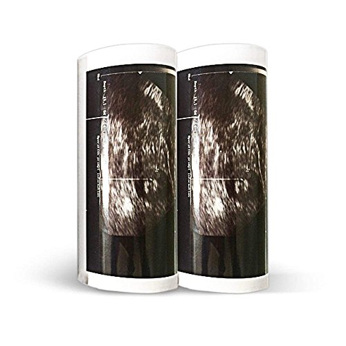 Черно-бяла термобумага Sony стандартната плътност, 10 ролки/бх